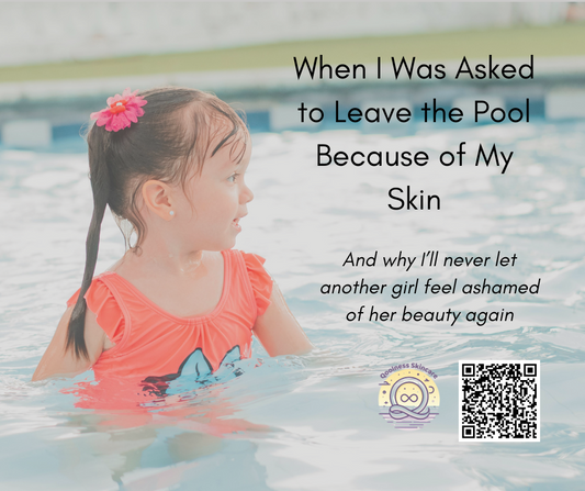 When I Was Asked to Leave the Pool Because of My Skin